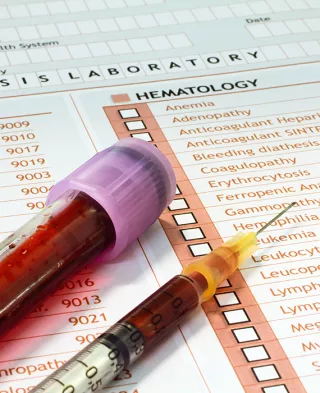 Photo of a vial of blood on top of lab results